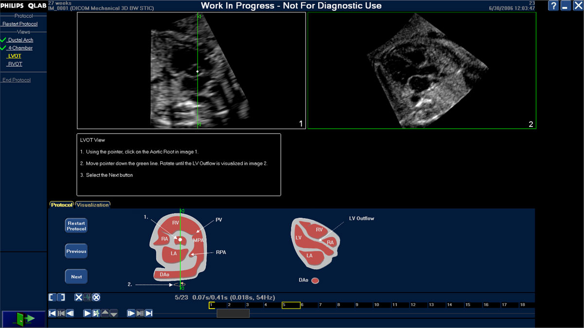 Imaging products